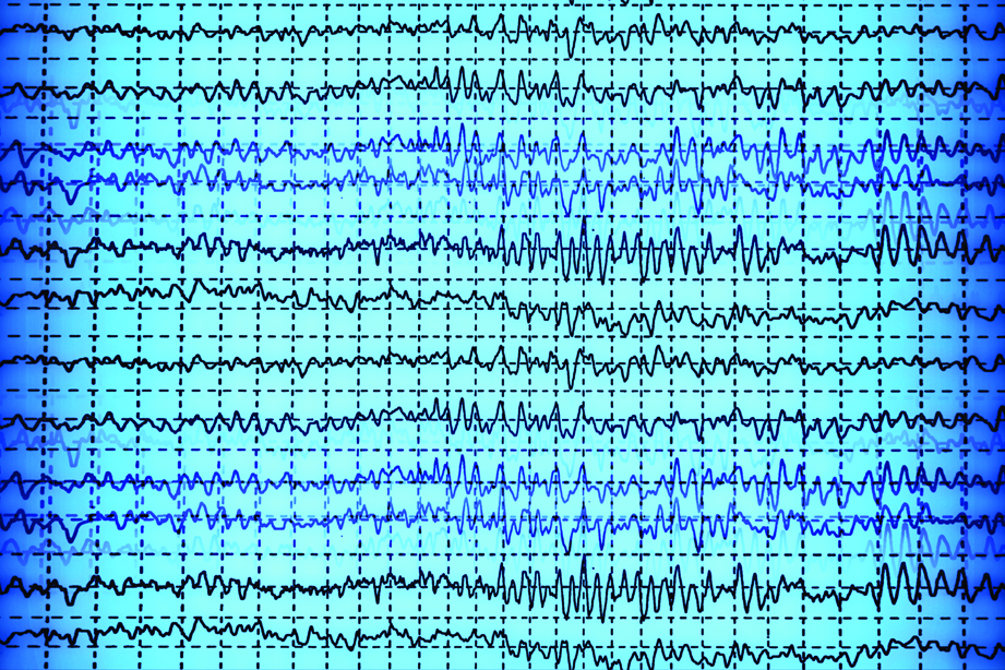 Towards Implementation of EEG and NIRS in the Clinic